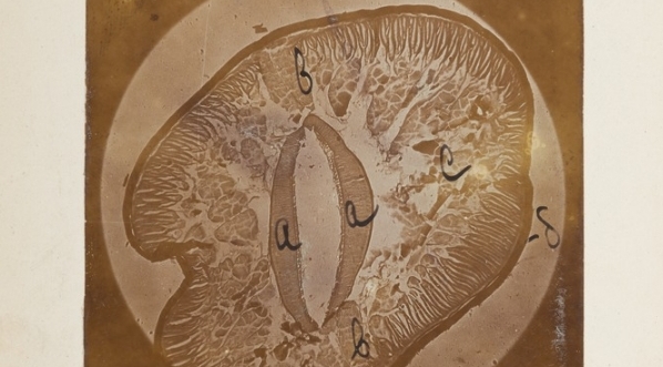  Zdjęcie mikroskopowe przekroju glisty ludzkiej.  
