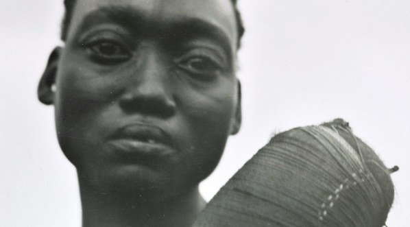  Prowincja Wschodnia, Mangbetu, deformacja czaszki.  